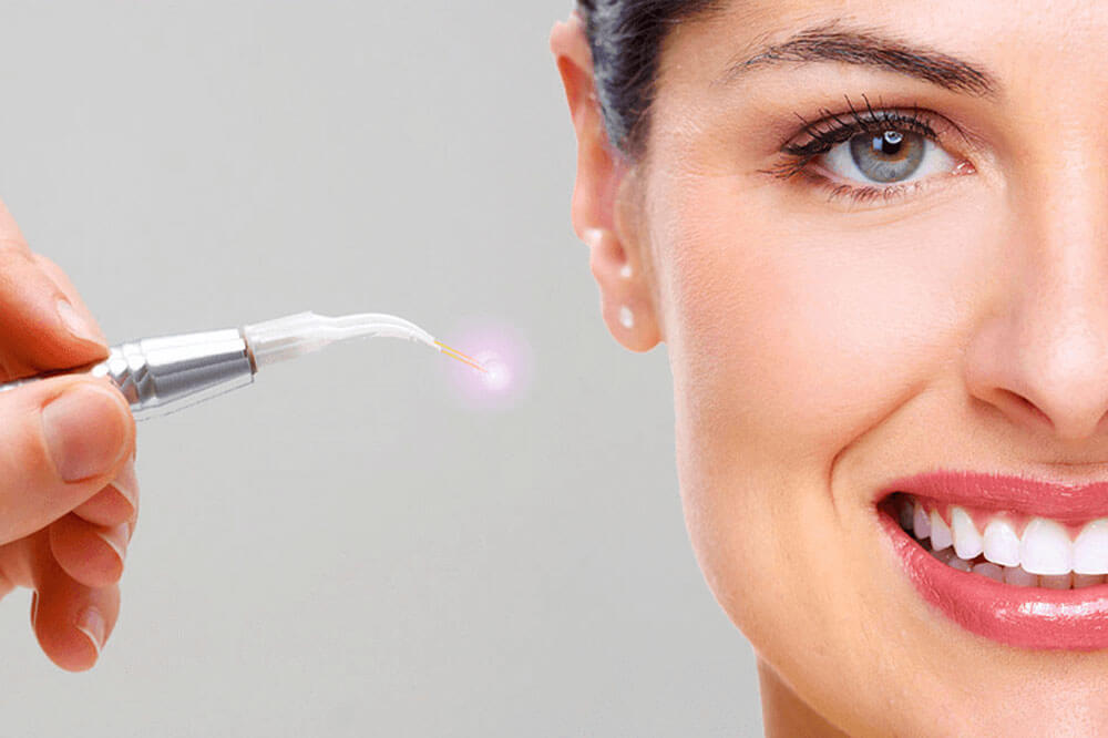 استفاده از لیزر در دندانپزشکی