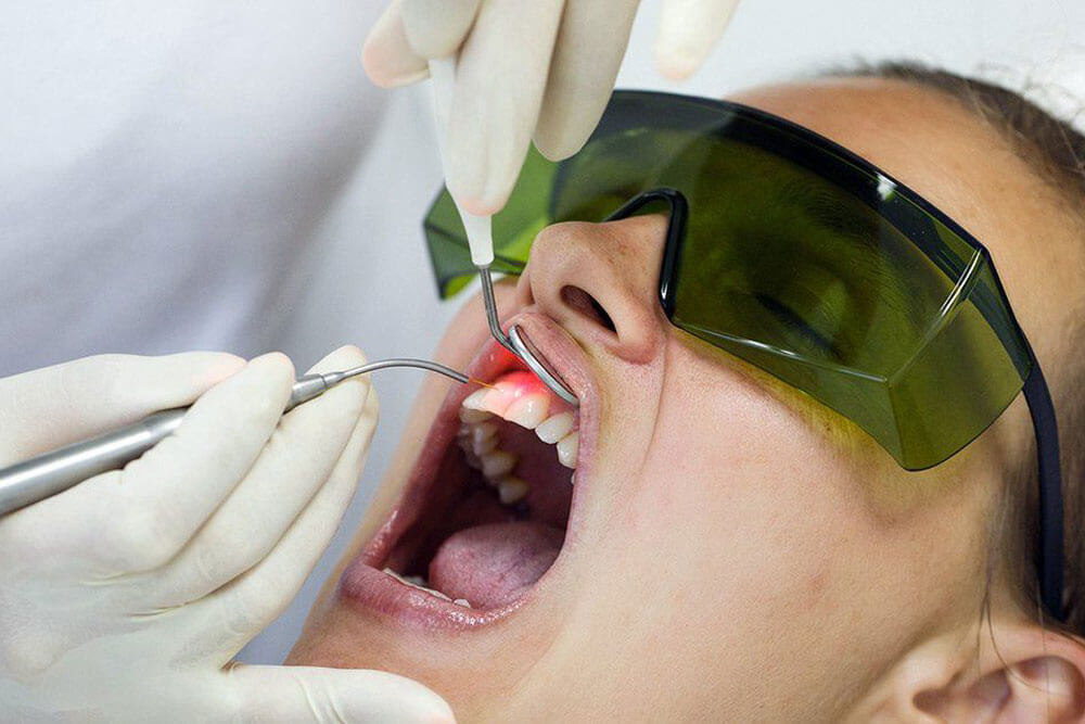 عوارض لیزر دندان